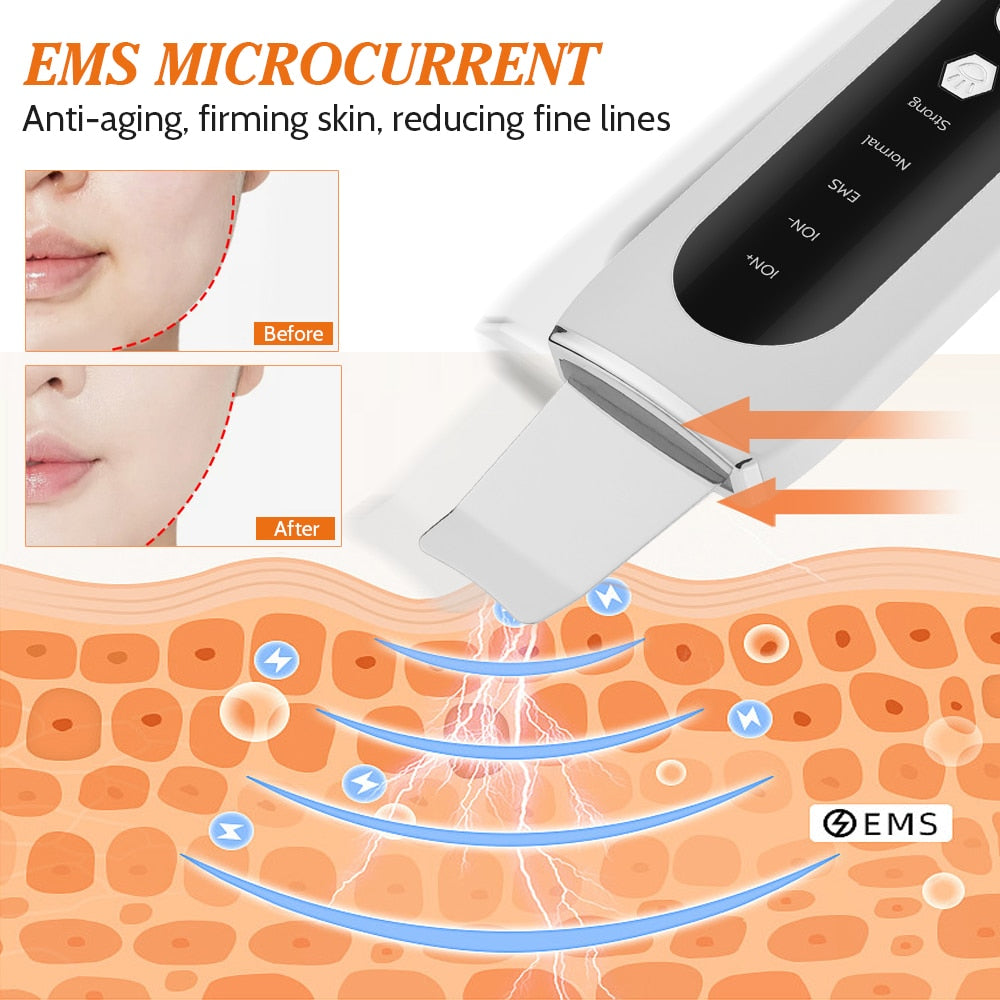 Ultrasonic Skin Scrubber – EMS Lifting & Djuprengörande Ansiktspeeling
