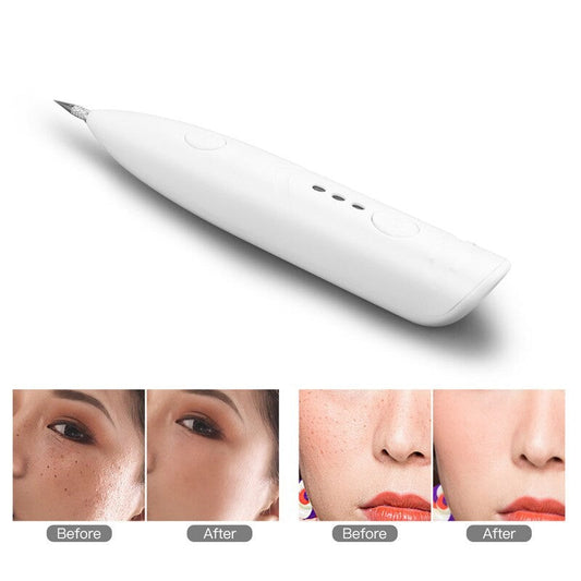 Electric Mini Laser Pen – Ta bort hudfläckar, födelsemärken & pigmentfläckar hemma