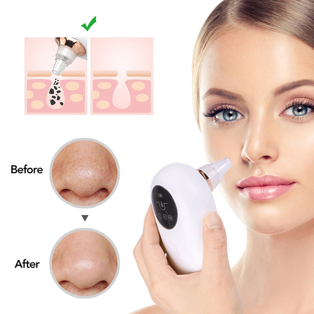 Portable Face Vacuum – Djuprengörande Porrenare & Pormaskborttagare